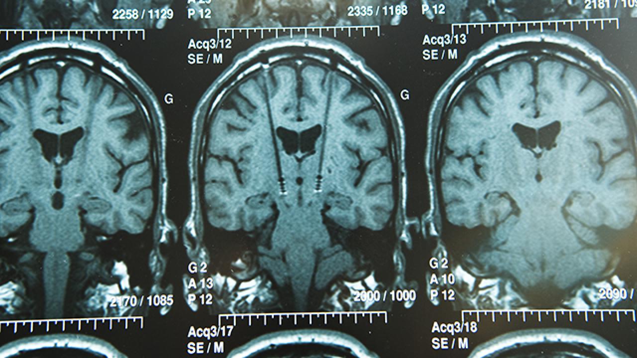 An image of cranial x-rays