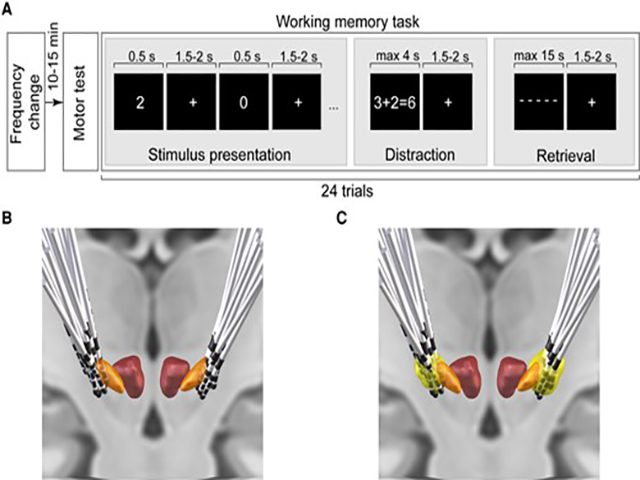 Figure depicting experimental paradigm and electrode location.