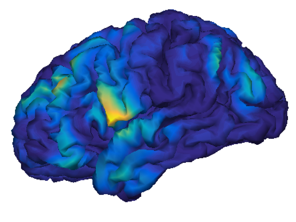 EEG source reconstruction