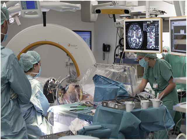 An image of a neurological surgery team and patient in an operating room
