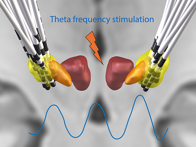 An illustration depicting theta frequency stimulation