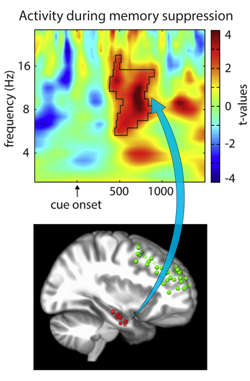 A figure of a heat map and a image of a brain 